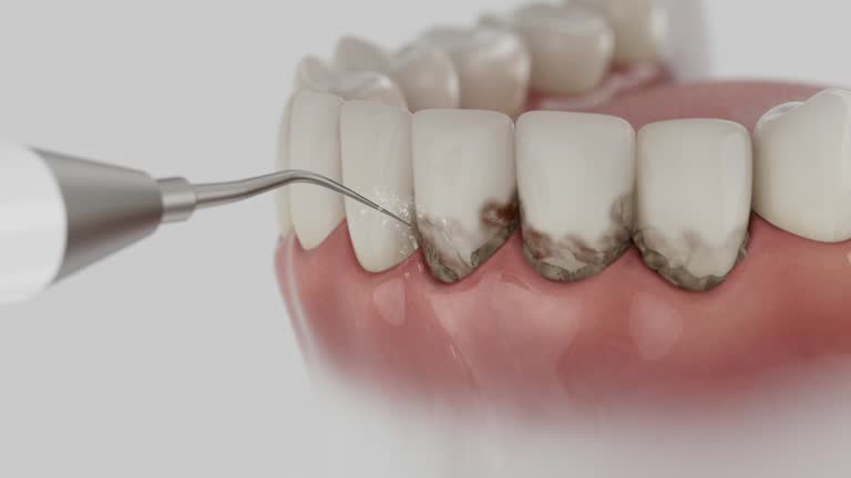 Trusted Teeth Cleaning And Checkup service in Ferndale, CA - Dentist Open Now